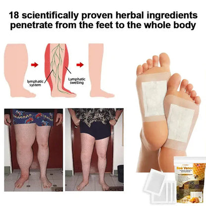 Bee Venom Lymphatic Drainage & Slimming Foot Patches (Pack of 10 Patches)
